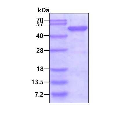 SDS-PAGE Recombinant Human SNX1 His Protein